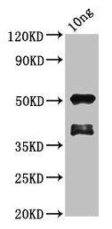Western Blot Positive WB detected in Recombinant protein All lanes: brca2 antibody at 1.7µg/ml Secondary Goat polyclonal to rabbit IgG at 1/50000 dilution Predicted band size: 45 kDa Observed band size: 52 kDa