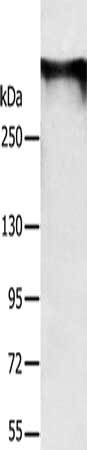 Gel: 6%SDS-PAGE, Lysate: 40 ug, Lane: Mouse brain tissue, Primary antibody: CSB-PA243333(RYR1 Antibody) at dilution 1/300, Secondary antibody: Goat anti rabbit IgG at 1/8000 dilution, Exposure time: 3 minutes