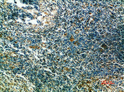 Immunohistochemical analysis of paraffin-embedded human-tonsils, antibody was diluted at 1:200