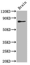 Western Blot Positive WB detected in: Zebrafish brain tissue All lanes: skib antibody at 5ug/ml Secondary Goat polyclonal to rabbit IgG at 1/50000 dilution Predicted band size: 80 kDa Observed band size: 80 kDa