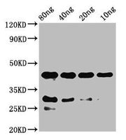 Western Blot Positive WB detected in Recombinant protein All lanes: notchl antibody at 2µg/ml Secondary Goat polyclonal to rabbit IgG at 1/50000 dilution Predicted band size: 42 kDa Observed band size: 42 kDa