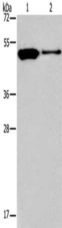 Gel: 8%SDS-PAGE, Lysate: 40 ug, Lane 1-2: A375 cells, A431 cells, Primary antibody: CSB-PA243766(MAF Antibody) at dilution 1/1050, Secondary antibody: Goat anti rabbit IgG at 1/8000 dilution, Exposure time: 10 seconds