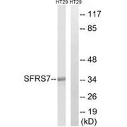 Western blot analysis of extracts from HT-29 cells, using SFRS7 antibody.