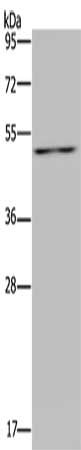 Gel: 8%SDS-PAGE, Lysate: 40 ug, Lane: Hela cells, Primary antibody: CSB-PA244468(P2RX2 Antibody) at dilution 1/200, Secondary antibody: Goat anti rabbit IgG at 1/8000 dilution, Exposure time: 10 minutes