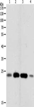 Gel: 10%SDS-PAGE, Lysate: 40 ug, Lane 1-4: K562 cells, 231 cells, Hela cells, Human fetal brain tissue, Primary antibody: CSB-PA244505(RHOA Antibody) at dilution 1/450, Secondary antibody: Goat anti rabbit IgG at 1/8000 dilution, Exposure time: 3...