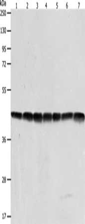 Gel: 10%SDS-PAGE, Lysate: 40 ug, Lane 1-7: Hela cells, Jurkat cells, NIH/3T3 cells, human fetal liver tissue, mouse brain tissue, A431 cells, 293T cells, Primary antibody: CSB-PA244513(ACTB Antibody) at dilution 1/600, Secondary antibody: Goat ant...