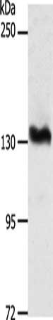 Gel: 8%SDS-PAGE, Lysate: 40 ug, Lane: PC3 cells, Primary antibody: CSB-PA244586(ADAMTS16 Antibody) at dilution 1/1350, Secondary antibody: Goat anti rabbit IgG at 1/8000 dilution, Exposure time: 30 minutes