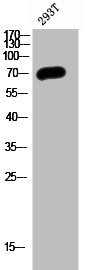 Western Blot analysis of 293T cells using PP2A-B56-δ Polyclonal Antibody