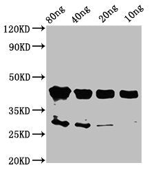 Western Blot Positive WB detected in Recombinant protein All lanes: olig2 antibody at 2µg/ml Secondary Goat polyclonal to rabbit IgG at 1/50000 dilution Predicted band size: 44 kDa Observed band size: 44 kDa