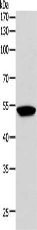 Gel: 10%SDS-PAGE, Lysate: 40 ug, Lane: A431 cells, Primary antibody: CSB-PA245689(F10 Antibody) at dilution 1/200, Secondary antibody: Goat anti rabbit IgG at 1/8000 dilution, Exposure time: 10 seconds