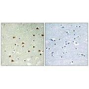 Immunohistochemistry analysis of paraffin-embedded human brain tissue using ABHD14B antibody.