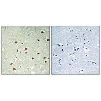 Immunohistochemistry analysis of paraffin-embedded human brain tissue using ABHD14B antibody.
