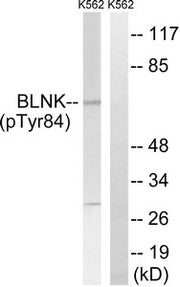Western blot analysis of extracts from K562 cells, treated with starved (24hours), using BLNK (Phospho-Tyr84) antibody. The lane on the right is treated with the synthesized peptide.