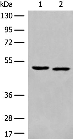 Gel: 8%SDS-PAGE, Lysate: 40 ug, Lane 1-2: Mouse brain tissue and HEPG2 cell lysates, Primary antibody: CSB-PA246721(ALX4 Antibody) at dilution 1/250, Secondary antibody: Goat anti rabbit IgG at 1/8000 dilution, Exposure time: 2 minutes