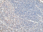 The image on the left is immunohistochemistry of paraffin-embedded Human tonsil tissue using CSB-PA246804(COX4I1 Antibody) at dilution 1/20, on the right is treated with synthetic peptide. (Original magnification: ×200)