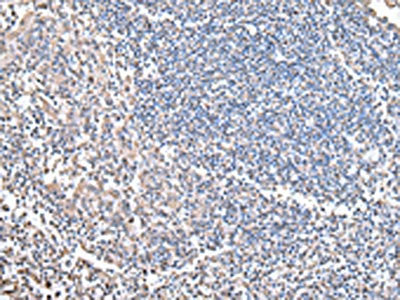 The image on the left is immunohistochemistry of paraffin-embedded Human tonsil tissue using CSB-PA246804(COX4I1 Antibody) at dilution 1/20, on the right is treated with synthetic peptide. (Original magnification: ×200)