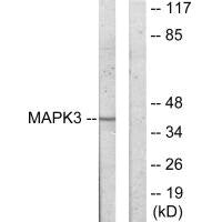 Western blot analysis of extracts from COLO205 cells, using MAPK3 antibody.