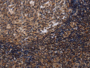 The image on the left is immunohistochemistry of paraffin-embedded Human tonsil tissue using CSB-PA248105(NTMT1 Antibody) at dilution 1/40, on the right is treated with fusion protein. (Original magnification: ×200)