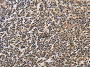 The image on the left is immunohistochemistry of paraffin-embedded Human tonsil tissue using CSB-PA248125(DRG1 Antibody) at dilution 1/20, on the right is treated with fusion protein. (Original magnification: ×200)