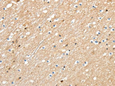 The image on the left is immunohistochemistry of paraffin-embedded Human brain tissue using CSB-PA248209(RRAD Antibody) at dilution 1/30, on the right is treated with synthetic peptide. (Original magnification: ×200)