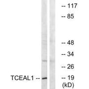 Western blot analysis of extracts from COLO cells, using TCEAL1 antibody.