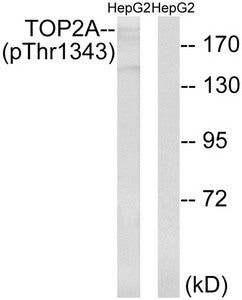 Western blot analysis of extracts from HepG2 cells treated with Ca2+ using TOP2A (Phospho-Thr1343) Antibody.The lane on the right is treated with the antigen-specific peptide.