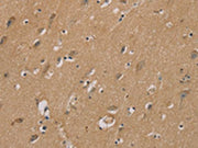 The image on the left is immunohistochemistry of paraffin-embedded Human brain tissue using CSB-PA248994(RAD51 Antibody) at dilution 1/40, on the right is treated with synthetic peptide. (Original magnification: ×200)