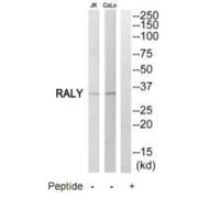 Western blot analysis of extracts from Jurkat cells and COLO205 cells, using RALY antibody.