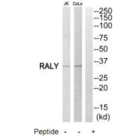 Western blot analysis of extracts from Jurkat cells and COLO205 cells, using RALY antibody.