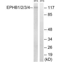 Western blot analysis of extracts from 3T3 cells, treated with heat shock, using EPHB1/2/3/4 (Ab-600/602/614/596) antibody.