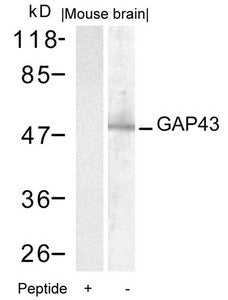 Western blot analysis of extracts from mouse brain tissue using GAP43(Ab-41) Antibody and the same antibody preincubated with blocking peptide.