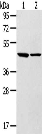 Gel: 8%SDS-PAGE,Lysate: 40 ug,Lane 1-2: Mouse brain tissue, Mouse liver tissue,Primary antibody: CSB-PA249070(LTB4R2 Antibody) at dilution 1/250 dilution,Secondary antibody: Goat anti rabbit IgG at 1/8000 dilution,Exposure time: 10 seconds