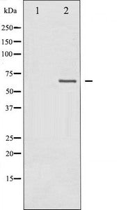 Western blot analysis of Merlin expression in IFN-α treated HuvEc whole cell lysates,The lane on the left is treated with the antigen-specific peptide.