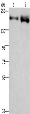 Gel: 8%SDS-PAGE, Lysate: 40 ug, Lane 1-2: LoVo cells, NIH/3T3 cells, Primary antibody: CSB-PA249846(BRD4 Antibody) at dilution 1/500, Secondary antibody: Goat anti rabbit IgG at 1/8000 dilution, Exposure time: 1 minute