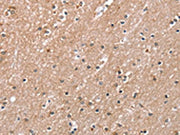 The image on the left is immunohistochemistry of paraffin-embedded Human brain tissue using CSB-PA249917(RAB8A Antibody) at dilution 1/45, on the right is treated with synthetic peptide. (Original magnification: ×200)