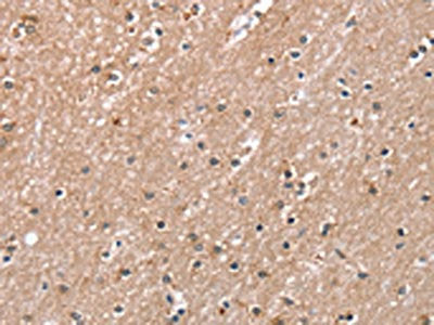 The image on the left is immunohistochemistry of paraffin-embedded Human brain tissue using CSB-PA249917(RAB8A Antibody) at dilution 1/45, on the right is treated with synthetic peptide. (Original magnification: ×200)