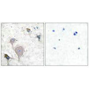 Immunohistochemical analysis of paraffin-embedded human brain tissue using Peripherin antibody.