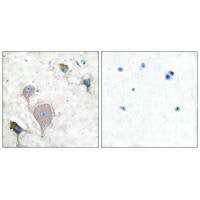 Immunohistochemical analysis of paraffin-embedded human brain tissue using Peripherin antibody.