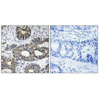 Immunohistochemistry analysis of paraffin-embedded human brain tissue using EIF1AY antibody.