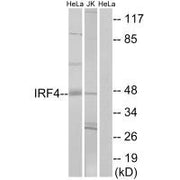 Western blot analysis of extracts from HeLa cells and Jurkat cells, using IRF4 antibody.