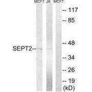 Western blot analysis of extracts from Jurkat cells and MCF-7 cells, using SEPT2 antibody.