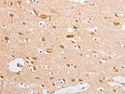 The image on the left is immunohistochemistry of paraffin-embedded Human brain tissue using CSB-PA250447(SERPINE2 Antibody) at dilution 1/20, on the right is treated with fusion protein. (Original magnification: ×200)