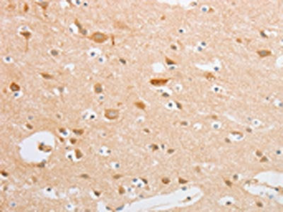 The image on the left is immunohistochemistry of paraffin-embedded Human brain tissue using CSB-PA250447(SERPINE2 Antibody) at dilution 1/20, on the right is treated with fusion protein. (Original magnification: ×200)