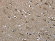 The image on the left is immunohistochemistry of paraffin-embedded Human brain tissue using CSB-PA250474(SYT3 Antibody) at dilution 1/50, on the right is treated with fusion protein. (Original magnification: ×200)