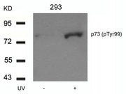 Western blot analysis of extracts from 293 cells untreated or treated with UV using p73(Phospho-Tyr99) Antibody.