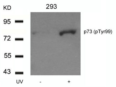 Western blot analysis of extracts from 293 cells untreated or treated with UV using p73(Phospho-Tyr99) Antibody.