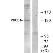 Western blot analysis of extracts from 293 cells, using PKCB1 antibody.