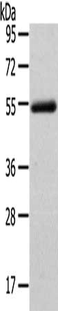 Gel: 8%SDS-PAGE, Lysate: 40 ug, Lane: Human normal liver tissue, Primary antibody: CSB-PA251585(FOXC1 Antibody) at dilution 1/400 dilution, Secondary antibody: Goat anti rabbit IgG at 1/8000 dilution, Exposure time: 3 minutes