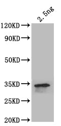 Western Blot Positive WB detected in: recombinant protein All lanes: beta-Spec Antibody at 1:1000 Secondary Goat polyclonal to rabbit IgG at 1/50000 dilution Predicted band size: 35.4 kDa Observed band size: 35.4 kDa