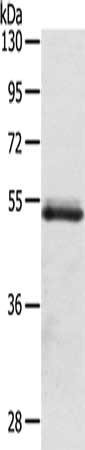 Gel: 6%SDS-PAGE, Lysate: 40 ug, Lane: Human normal colon sigmoideum tissue, Primary antibody: CSB-PA252042(OLFM4 Antibody) at dilution 1/200, Secondary antibody: Goat anti rabbit IgG at 1/8000 dilution, Exposure time: 3 minutes